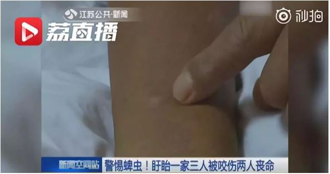 中山市民注意蜱蟲叮咬！請做好這些預(yù)防措施